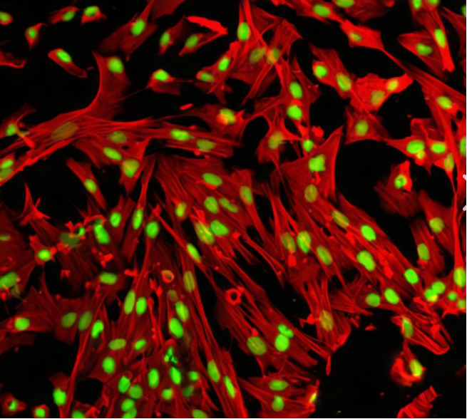 TRITC-Chitosan.png