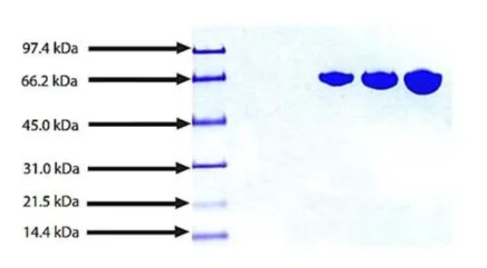 Transferrin