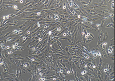 MG63骨肉瘤细胞膜包覆纳米载体