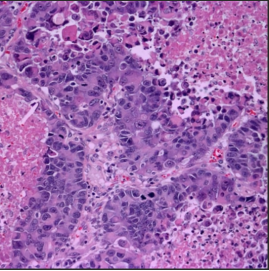H460大细胞膜肺**细胞膜包覆纳米载体