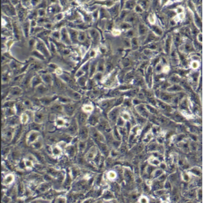 786-O肾透明细胞膜腺**细胞膜包覆纳米载体