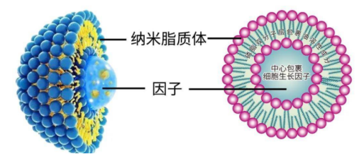 脂质体包裹药物阿苯达唑