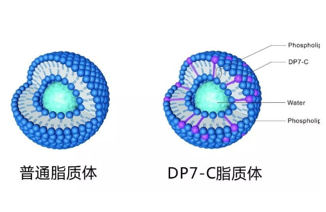 载长春新碱脂质体