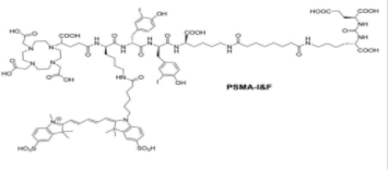 PSMA I＆F