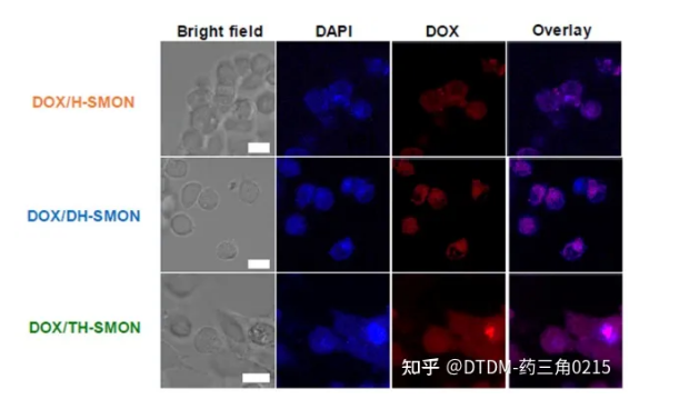 负载DOX的HSMON、DH-SMON和THS-MON处理MCF7细胞系1小时的共聚焦图像