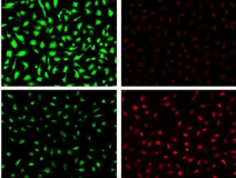 FITC-Estrogen  荧光素绿色荧光标记雌性激素  异硫氰基荧光素标记雌性激素 