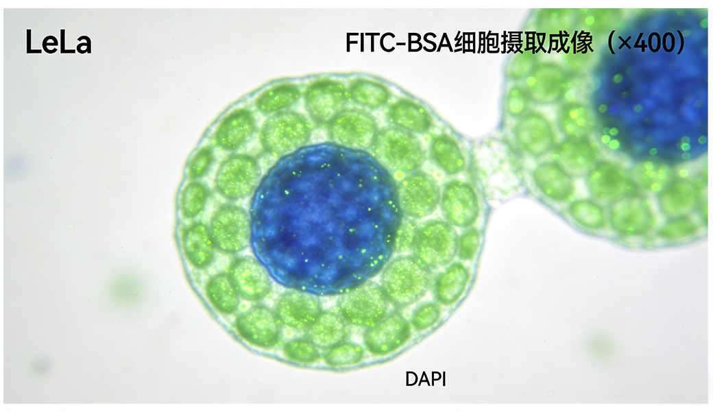 FITC-BSA处理HeLa细胞后的荧光成像图